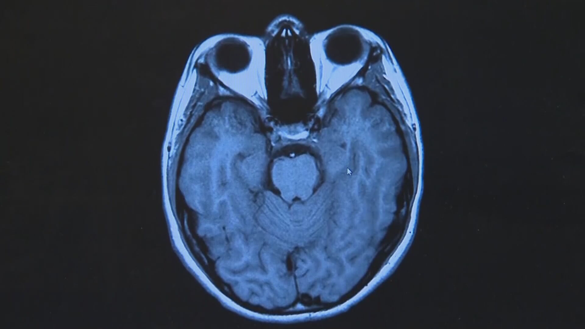 Sleep Apnea: Why Top Experts Are Calling This the Most Ingenious Pillow of 2025