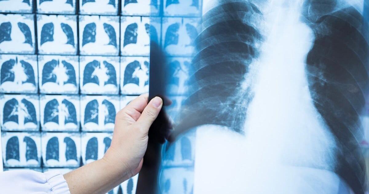 Sleep Apnea: Why Top Experts Are Calling This the Most Ingenious Pillow of 2025